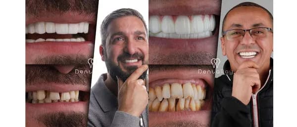 DentaRay Clinic Istanbul — photo 5 supplied by the facility