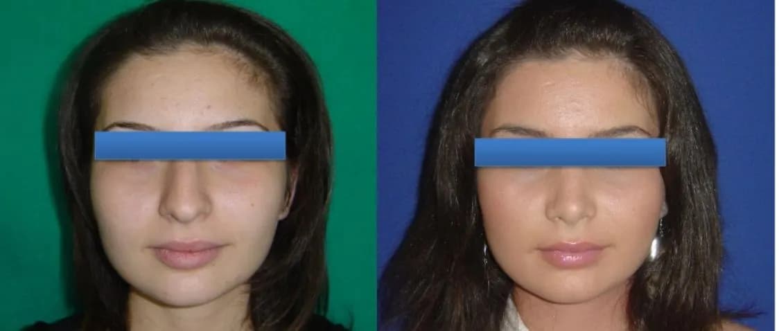 Dr. Cagri Sade Plastiс Surgery Center — photo 3 supplied by the facility
