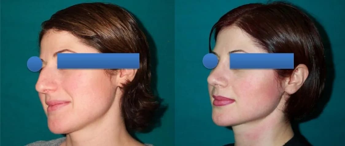 Dr. Cagri Sade Plastiс Surgery Center — photo 4 supplied by the facility