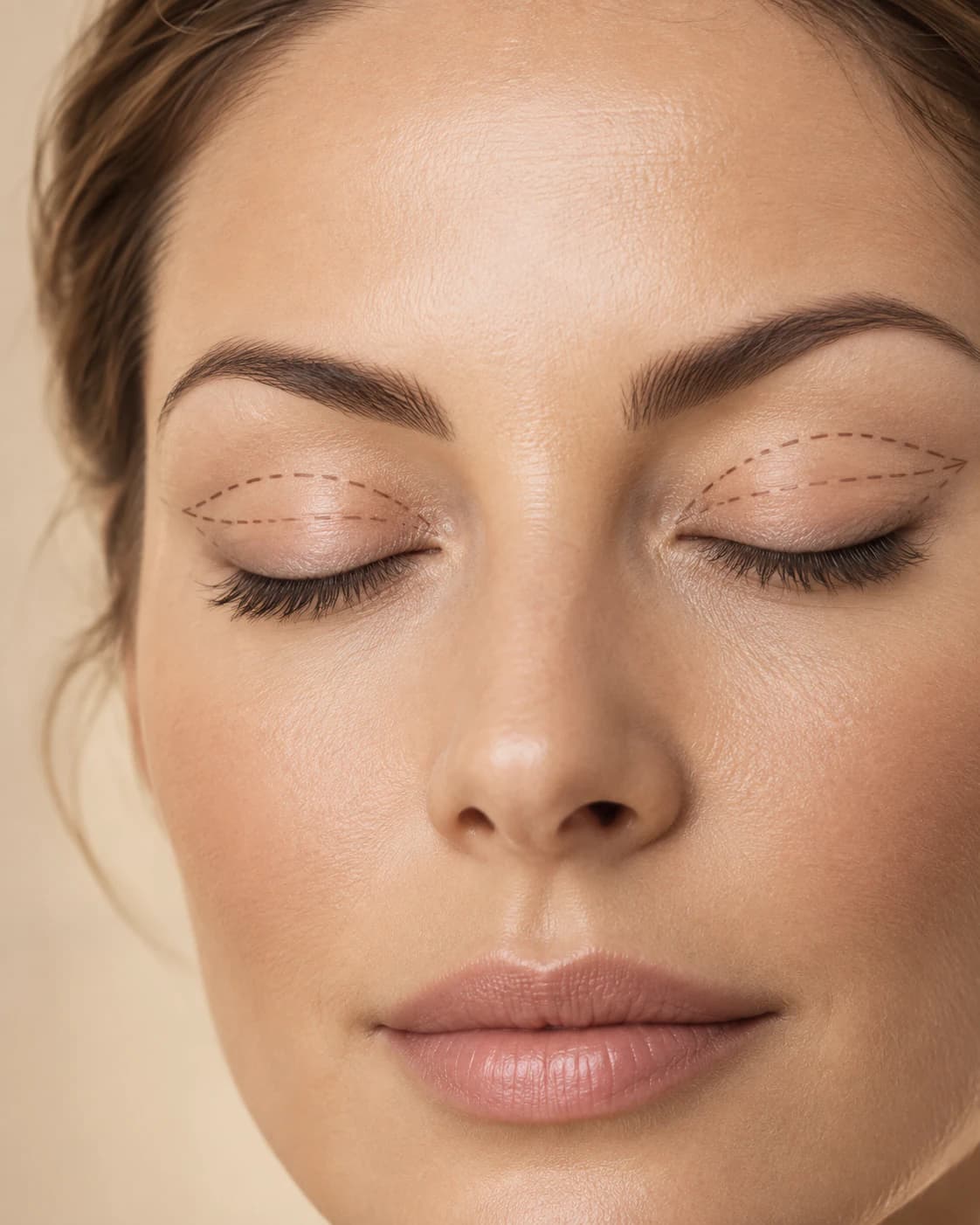 Blepharoplasty — a close study of the face in warm studio light