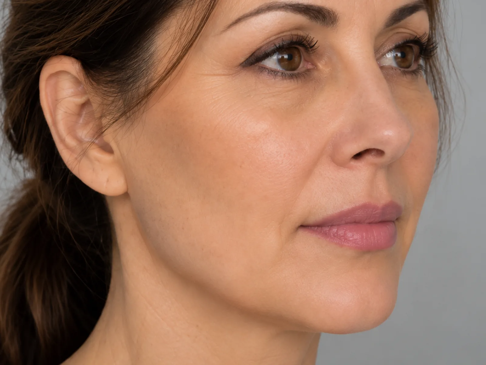 Illustrative image, after: a woman's face and neck, three-quarter view. Generated artwork, not a patient photograph.