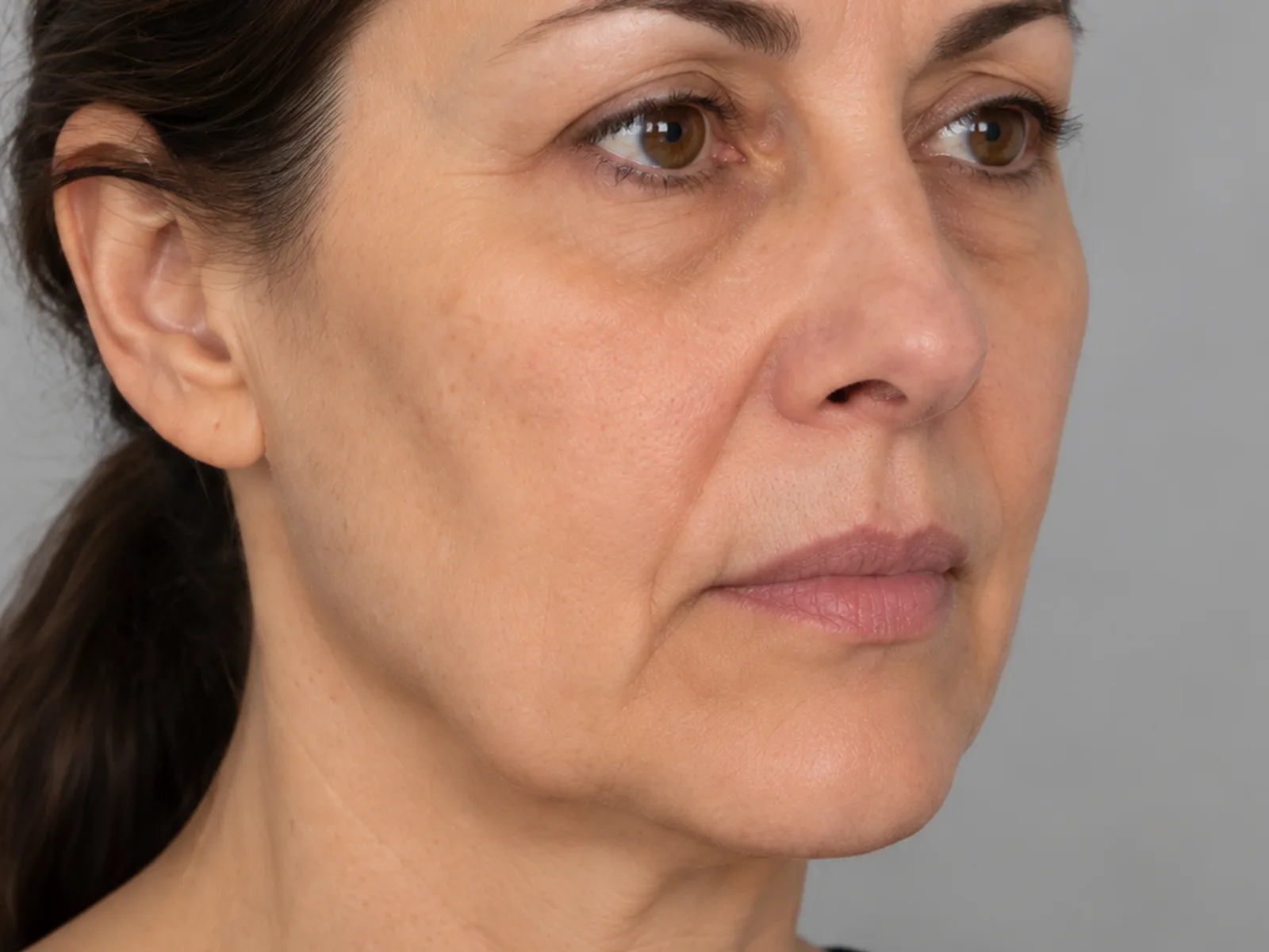 Illustrative image, before: a woman's face and neck, three-quarter view. Generated artwork, not a patient photograph.