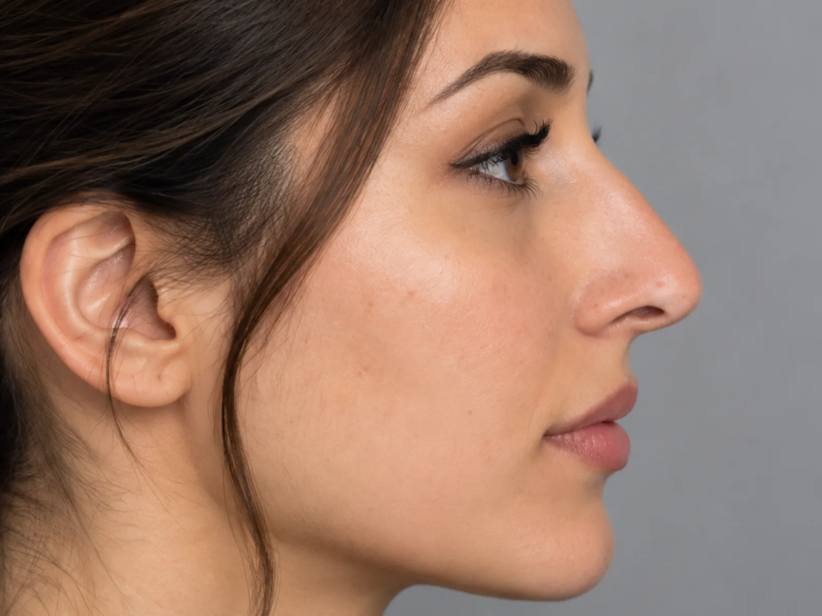 Illustrative image, after: a woman's nose in profile. Generated artwork, not a patient photograph.