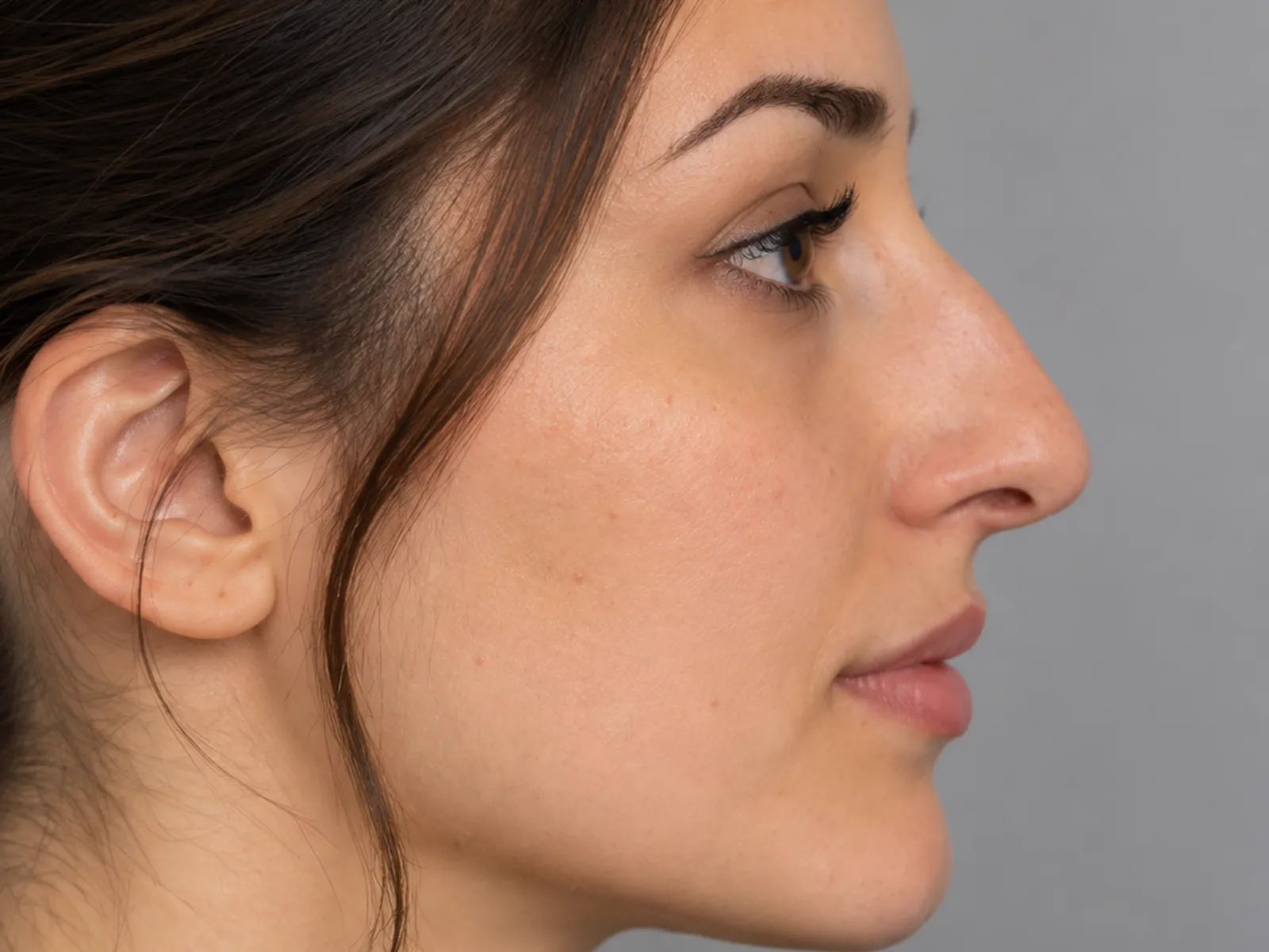 Illustrative image, before: a woman's nose in profile. Generated artwork, not a patient photograph.